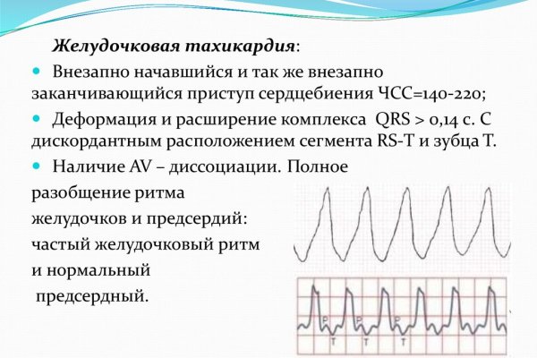 Почему не закрыт сайт кракен